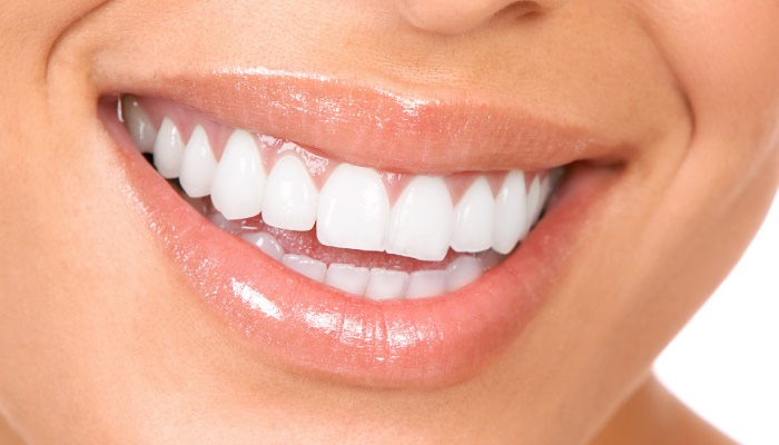 schöne weisse Zähne